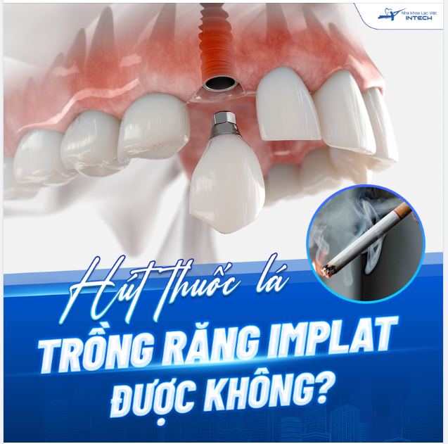 HÚT THUỐC LÁ CÓ TRỒNG RĂNG IMPLANT ĐƯỢC KHÔNG?