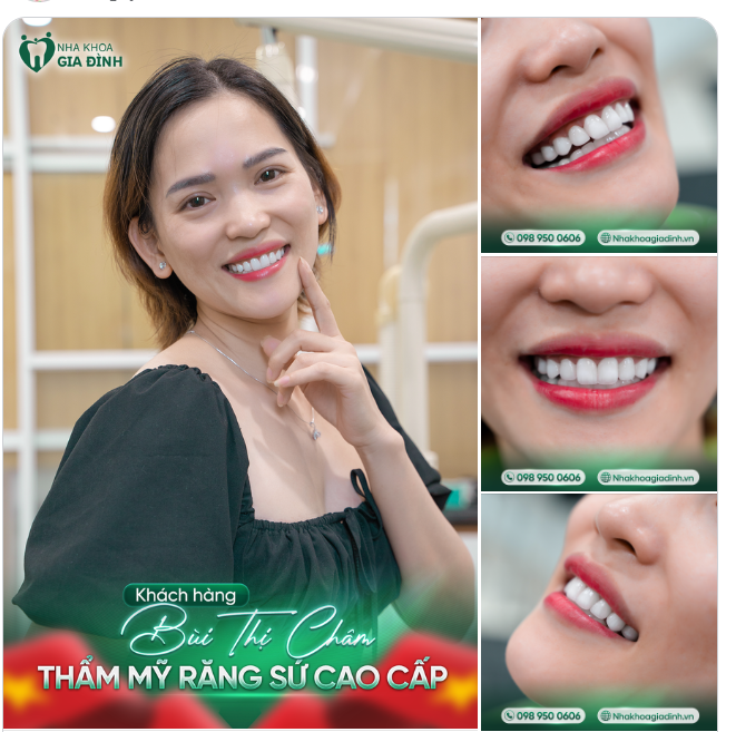 THẨM MỸ RĂNG SỨ MÀ NHÌN NHƯ RĂNG THẬT. BẠN CÓ MUỐN???