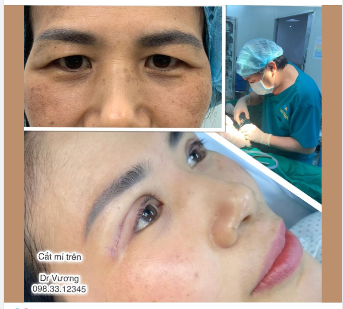 Trẻ hoá mắt ở người già với Dr Vương: