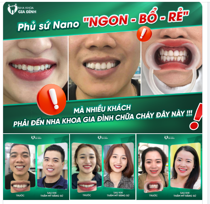 HAM RẺ CHỌN PHỦ SỨ NANO VÀ NHẬN CÁI KẾT ĐẮNG