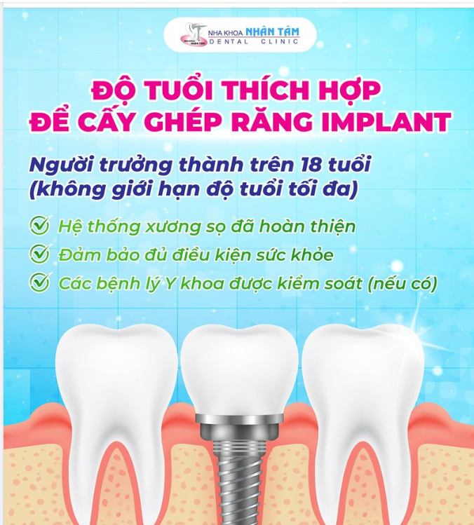 Độ tuổi nào là phù hợp để cấy ghép răng Implant?