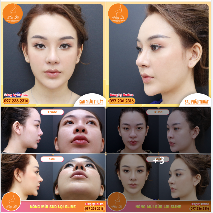 DÁNG MŨI CAO BAY - MẶT TÂY CUỐN HÚT