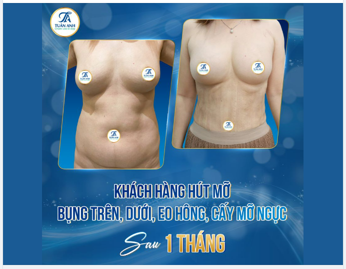 MỤC SỞ THỊ KH SAU KHI ĐIÊU KHẮC BODY