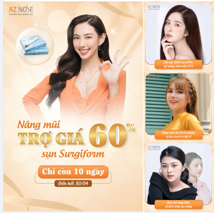 3 lí do bạn nên nâng mũi với sụn Surgiform vào tháng 4 này