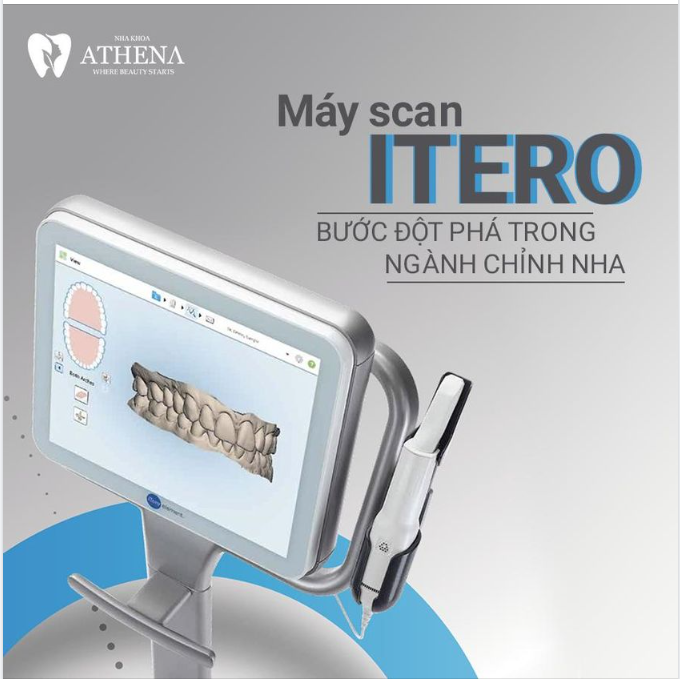 MÁY SCAN ITERO - BƯỚC ĐỘT PHÁ TRONG NGÀNH CHỈNH NHA