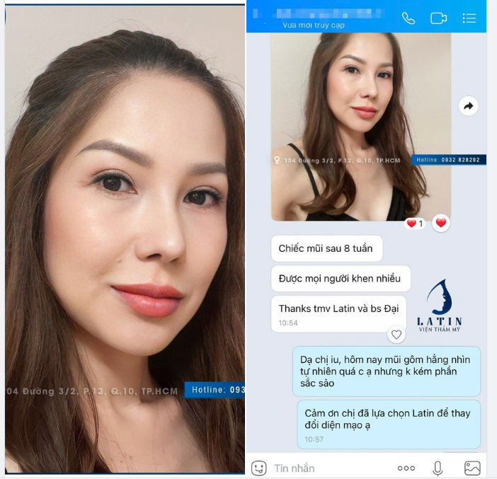 Feedback: Diện mạo sắc nét với dáng mũi mới 8 tuần tuổi
