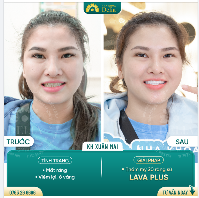 Chỉ 48H - Kiến tạo nụ cười trọn vẹn cho chị Xuân Mai