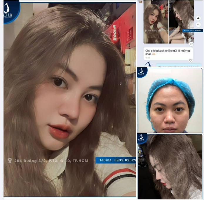FEEDBACK CHIẾC MŨI SAU 11 NGÀY TUỔI LÀM TẠI LATIN