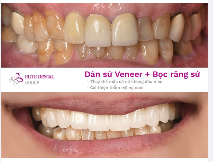 BÍ MẬT CỦA “NỤ CƯỜI ĐẸP CHƯA TỪNG CÓ!”