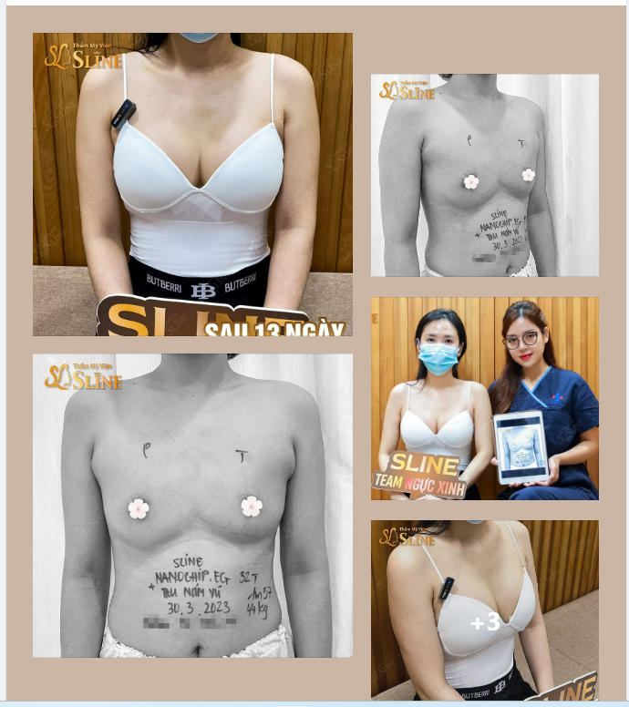 FEEDBACK : SAU 13 NGÀY NÂNG CẤP VÒNG 1