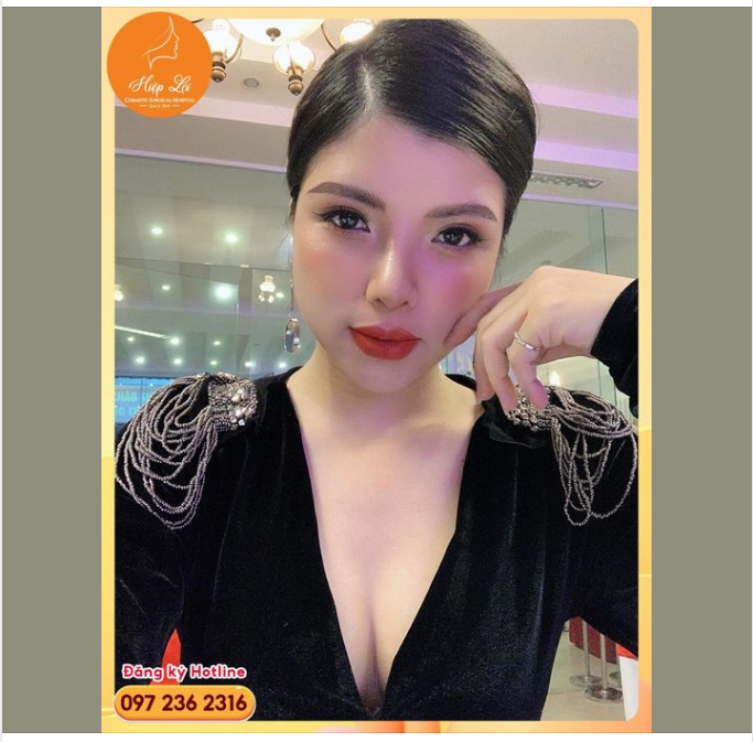 LÀM 1 ĐƯỢC 3 ​​​​​​​ Có ai tin rằng Diện mạo xinh đẹp hoàn hảo này được thực hiện chỉ trong 01 ngày ghé Hiệp Lợi