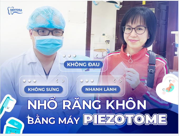 "Nhổ răng khôn có đau không?"