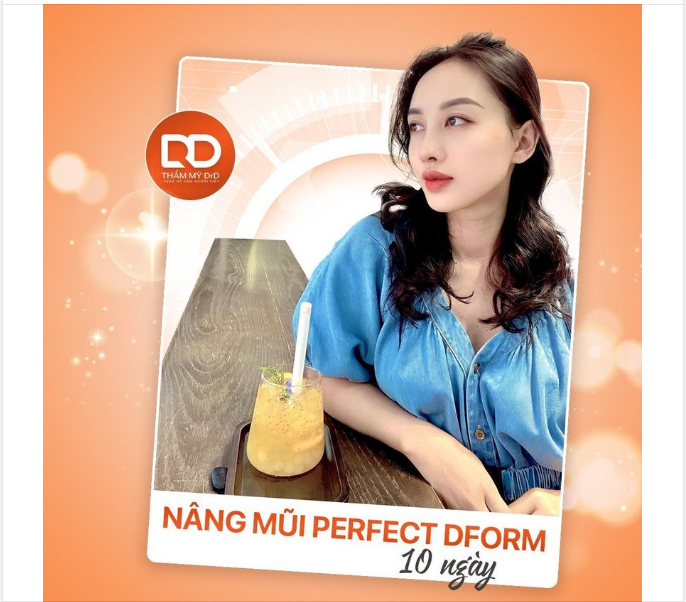 Ngắm ngay dáng mũi Perfect Dform 10 ngày tuổi nhé cả nhà