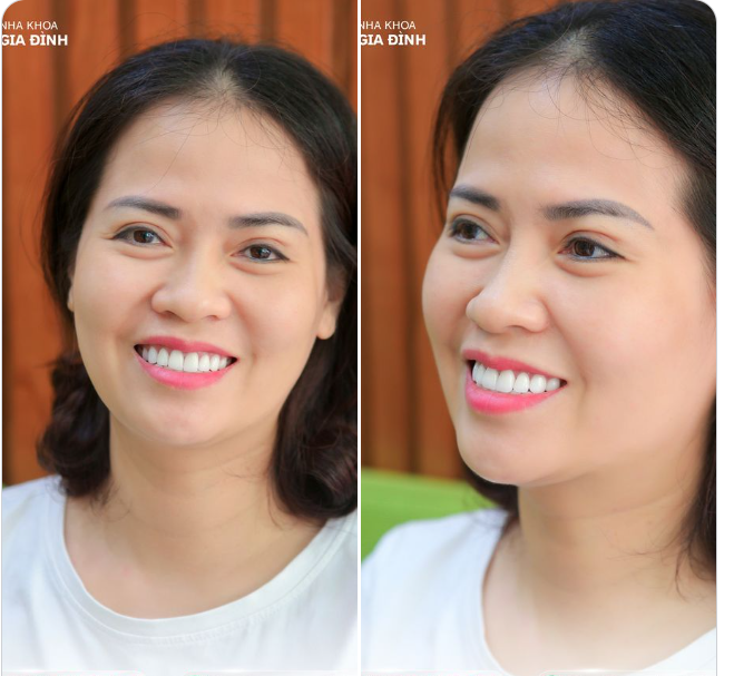 HÃY ĐỂ NỤ CƯỜI THAY ĐỔI CUỘC SỐNG