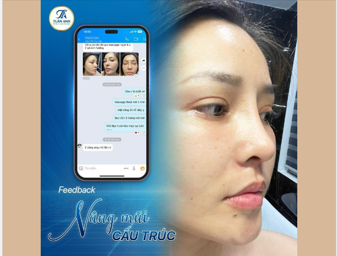 MŨI CAO TÂY ​​​​​​​ MẶT BABY GÓC NGHIÊNG THẦN THÁNH