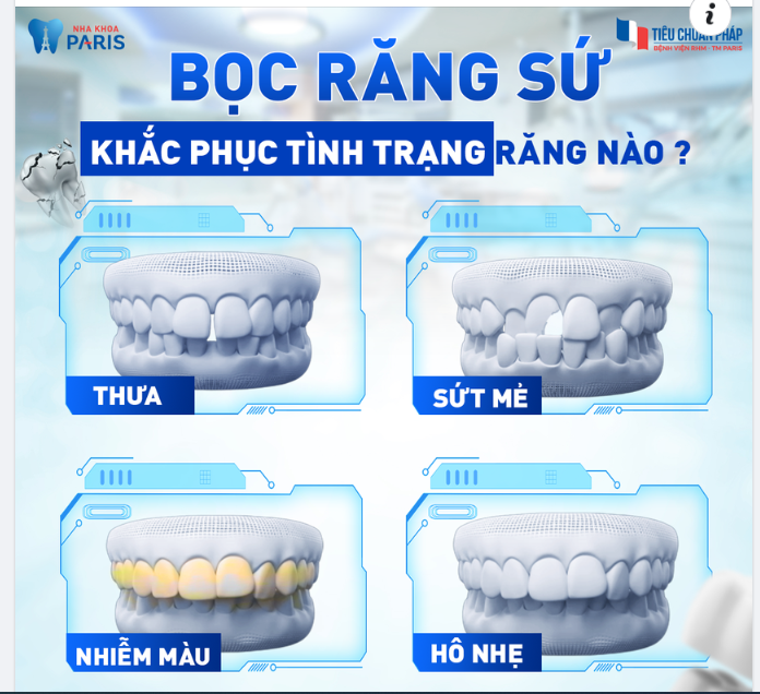 BẠN GẶP TÌNH TRẠNG NÀO - BỌC RĂNG SỨ KHẮC PHỤC TÌNH TRẠNG ĐÓ!