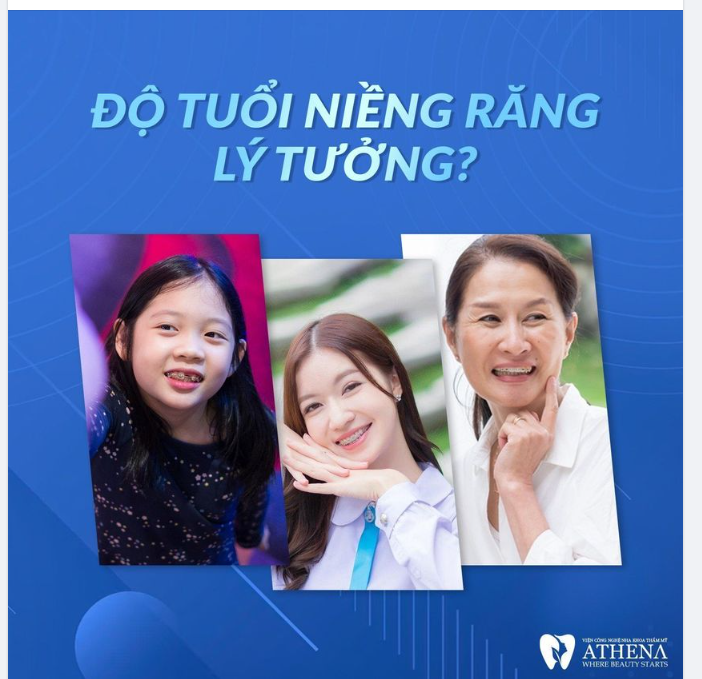 ĐỘ TUỔI NÀO CÓ THỂ NIỀNG RĂNG?