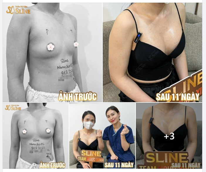 FEEDBACK NÂNG CẤP VÒNG 1.