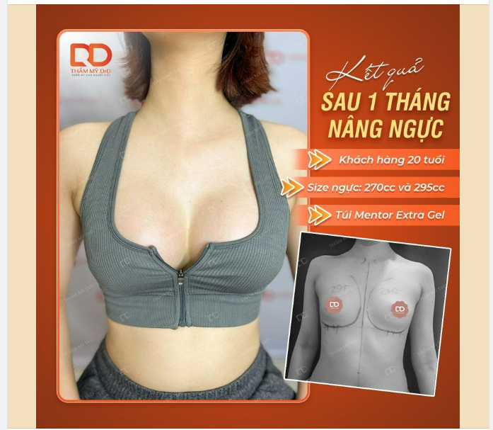 ĐỘ TUỔI NÀO PHÙ HỢP ĐỂ THỰC HIỆN NÂNG V1?
