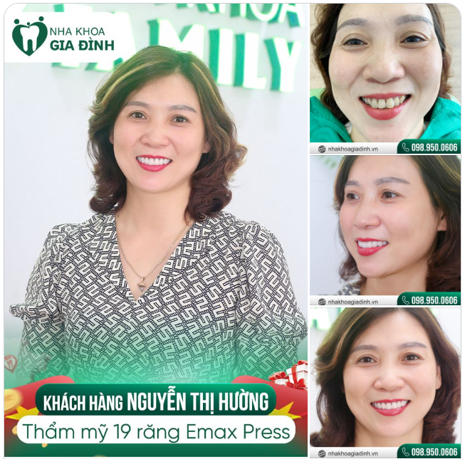 RẠNG RỠ NỤ CƯỜI - CHIẾN THẮNG TỰ TI
