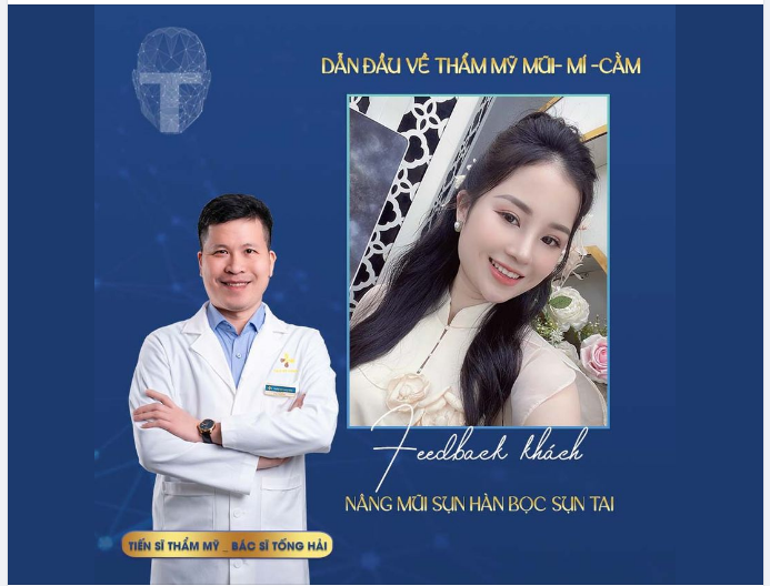 Dáng mũi S-line tự nhiên cho bạn khách hàng Hồng Nhung.