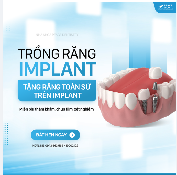PEACE DENTISTRY - TRUNG TÂM IMPLANT NHA KHOA HÀNG ĐẦU VIỆT NAM