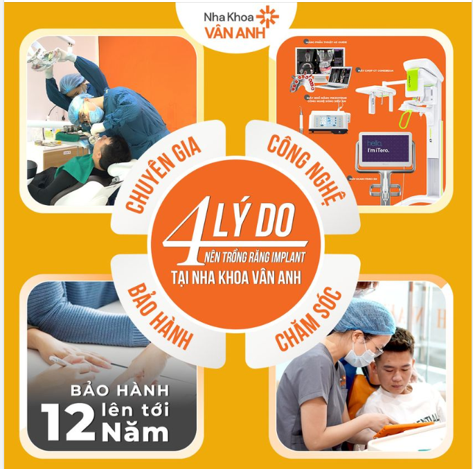 MẤT RĂNG Ở HÀ NỘI - CẤY GHÉP IMPLANT Ở ĐÂU ?