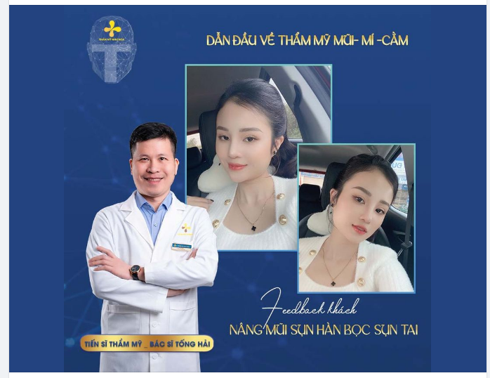 Dáng mũi S-line tự nhiên cho bạn khách hàng Hồng Nhung.