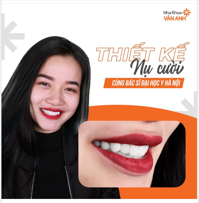 DESIGN SMILE CHO NỤ CƯỜI TỎA NẮNG