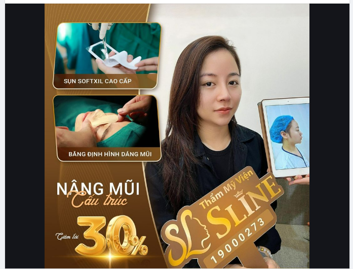 FEEDBACK NÂNG MŨI SOFTXIL - THAY ĐỔI DIỆN MẠO