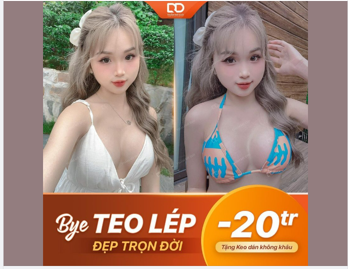V1 ĐẸP TRỌN ĐỜI - KHÔNG LO SẸO XẤU