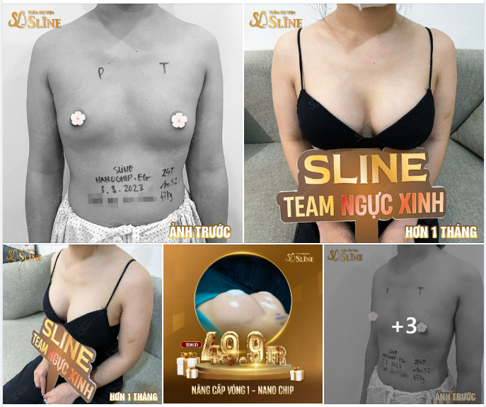 CŨNG LÀ VÒNG 1 NHƯNG SAU HƠN 1 THÁNG MÀ GIỜ NHÌN LẠ LẮM