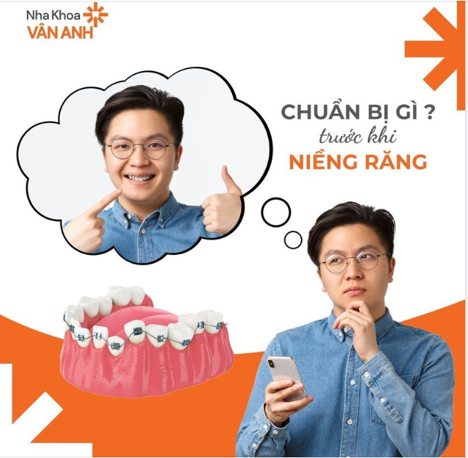 5 điều bạn cần chuẩn bị trước khi niềng răng