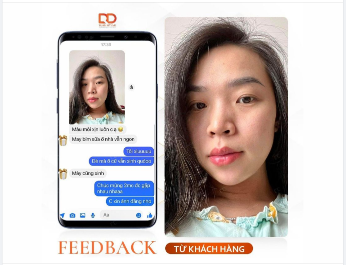 "BỈM SỮA" VẪN XINH TƯƠI NHỜ ĐÔI MÔI QUYẾN RŨ.