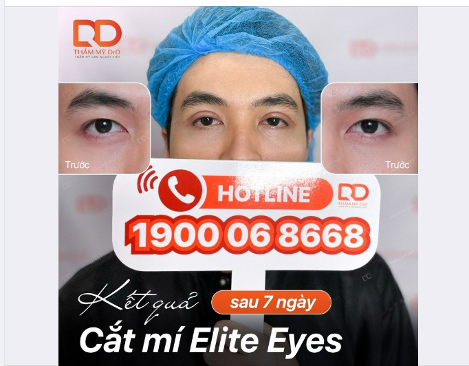 KẾT QUẢ CẮT MÍ NAM SAU 7 NGÀY THỰC HIỆN