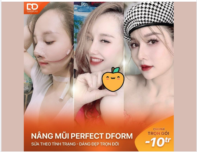 "Săn" ưu đãi Nâng mũi với chi phí cực hời
