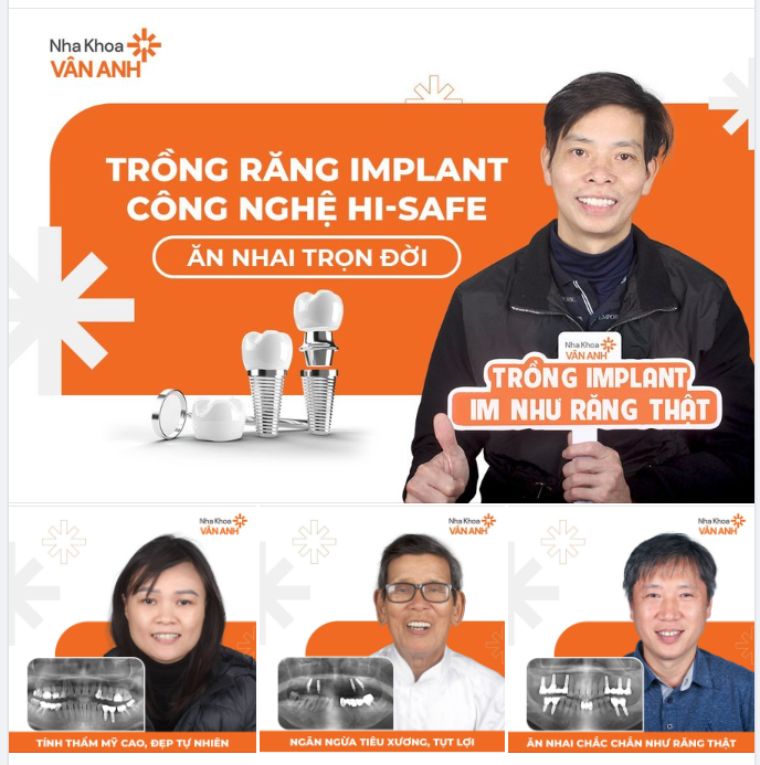 ĂN NHAI THOẢI MÁI, SỨC KHỎE CẢI THIỆN NHỜ TRỒNG RĂNG IMPLANT