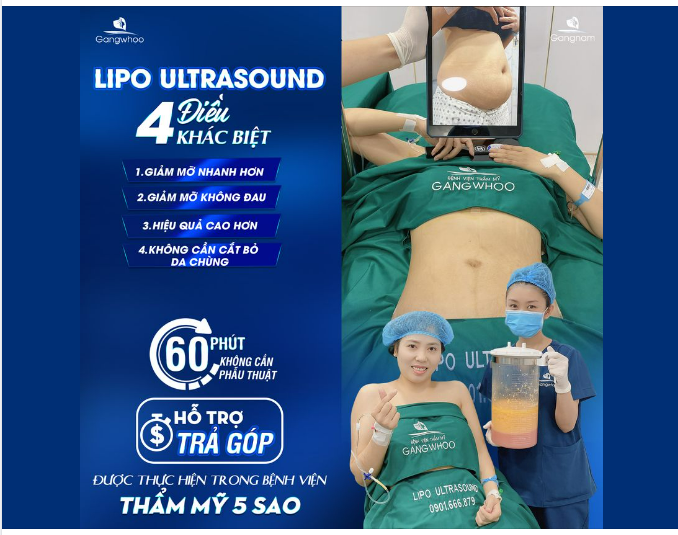 CHÍNH TAY CẦM LƯỢNG MỠ THỪA TRÊN TAY LÀ CẢM GIÁC GÌ?