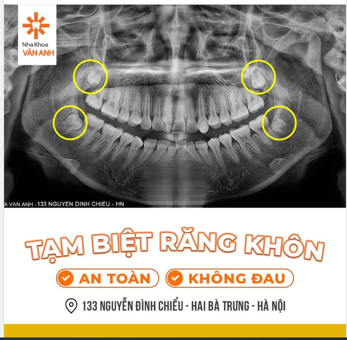 HÀ NỘI ​​​​​​​ TẠM BIỆT RĂNG 