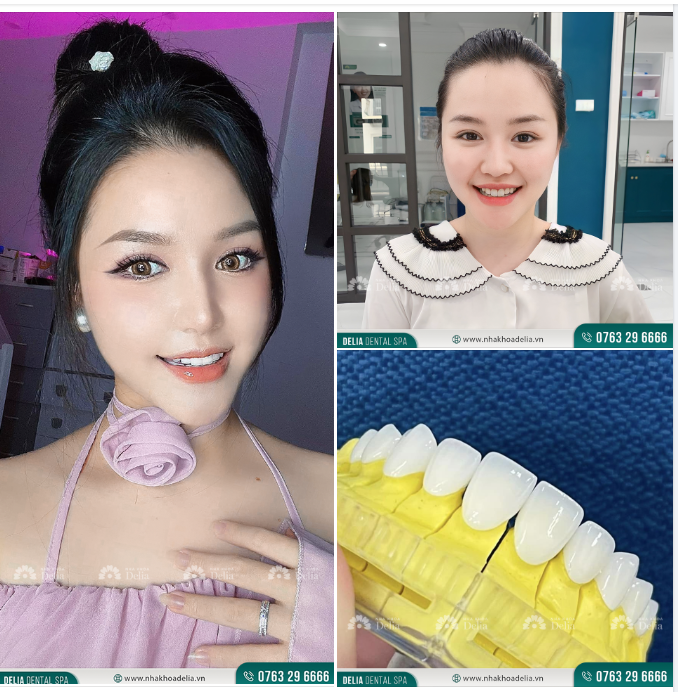 Nụ cười khoẻ đẹp trọn vẹn tạo nên cuộc sống hạnh phúc thăng hoa!