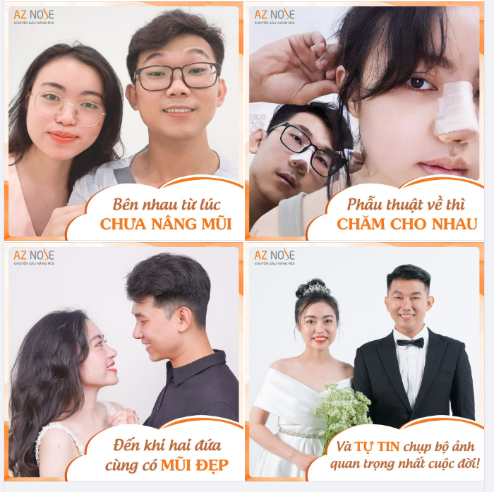 Couple cùng nâng mũi để tự tin chụp bộ ảnh quan trọng nhất cuộc đời