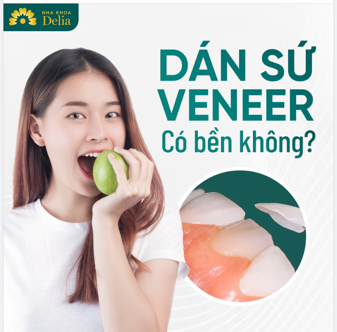 Dán sứ Veneer - Bền chắc trọn đời tại nha khoa Delia