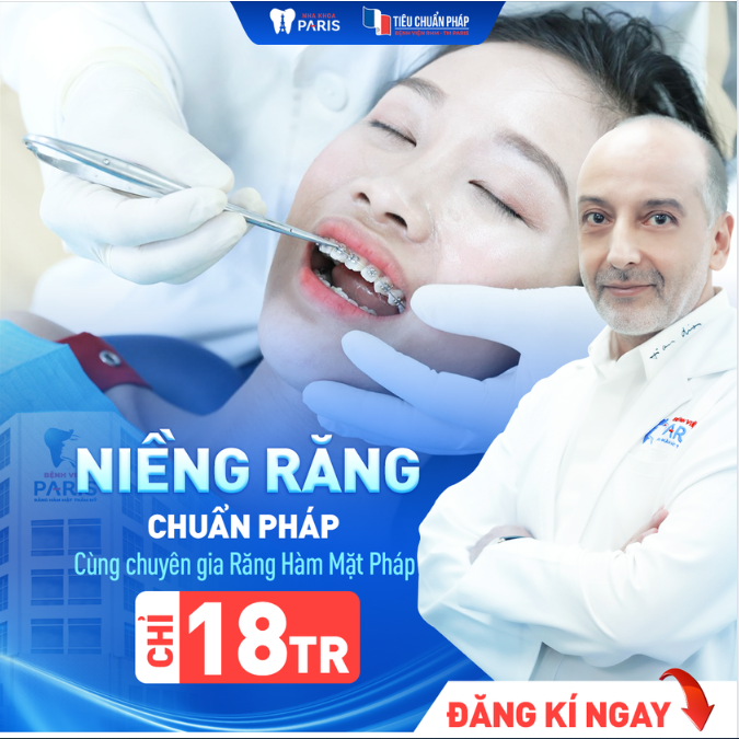 CƠ HỘI NIỀNG RĂNG CHỈ 18 TRIỆU