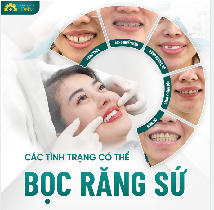 THẨM MỸ RĂNG SỨ XỬ LÝ MỌI TÌNH TRẠNG RĂNG - CHỈ 2 LẦN HẸN
