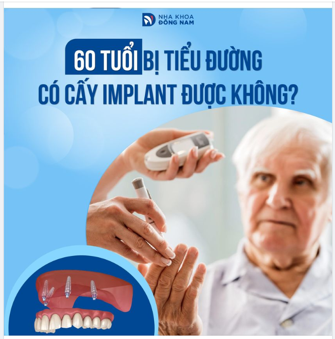 BÁC SĨ GIẢI ĐÁP 60 TUỔI BỊ TIỂU ĐƯỜNG CÓ CẤY IMPLANT ĐƯỢC KHÔNG
