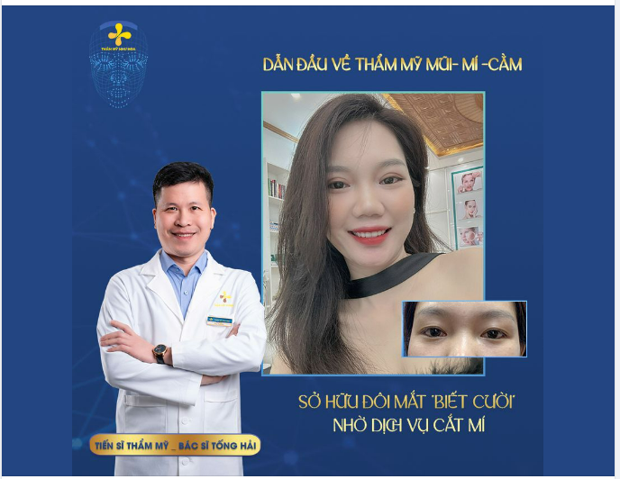 SỞ HỮU ĐÔI MẮT “BIẾT CƯỜI” - XÓA BỎ MÍ NHỎ, MẮT BUỒN