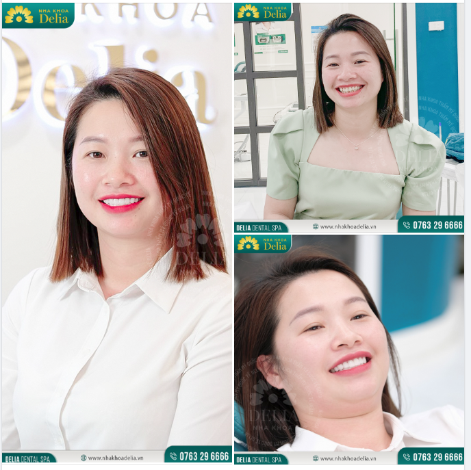 Trọn vẹn nụ cười - Rạng rỡ thanh xuân