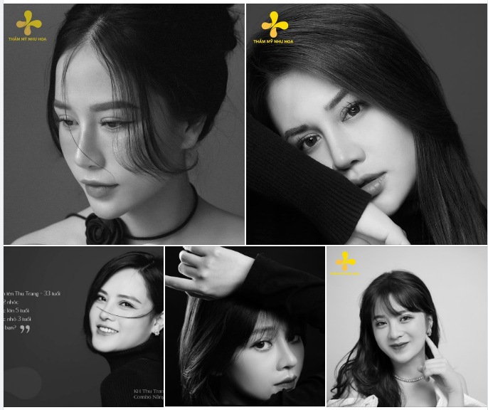 Bộ ảnh chân dung đen trắng của các bạn khách Thẩm Mỹ Như Hoa. Màu sắc giản dị, mộc mạc nhưng lại rất thần thái, tinh tế, thu hút ánh nhìn của mọi người.