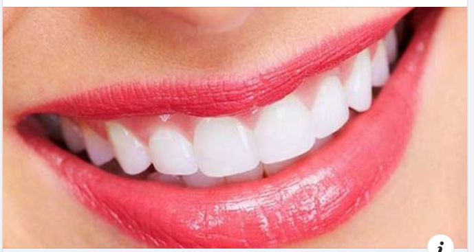 Tẩy trắng răng có làm hỏng men răng không?