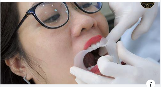 Bọc răng sứ thẩm mỹ là gì? có tốt không? có đau không?